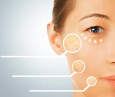 woman-with-dry-parts-of-face-skin